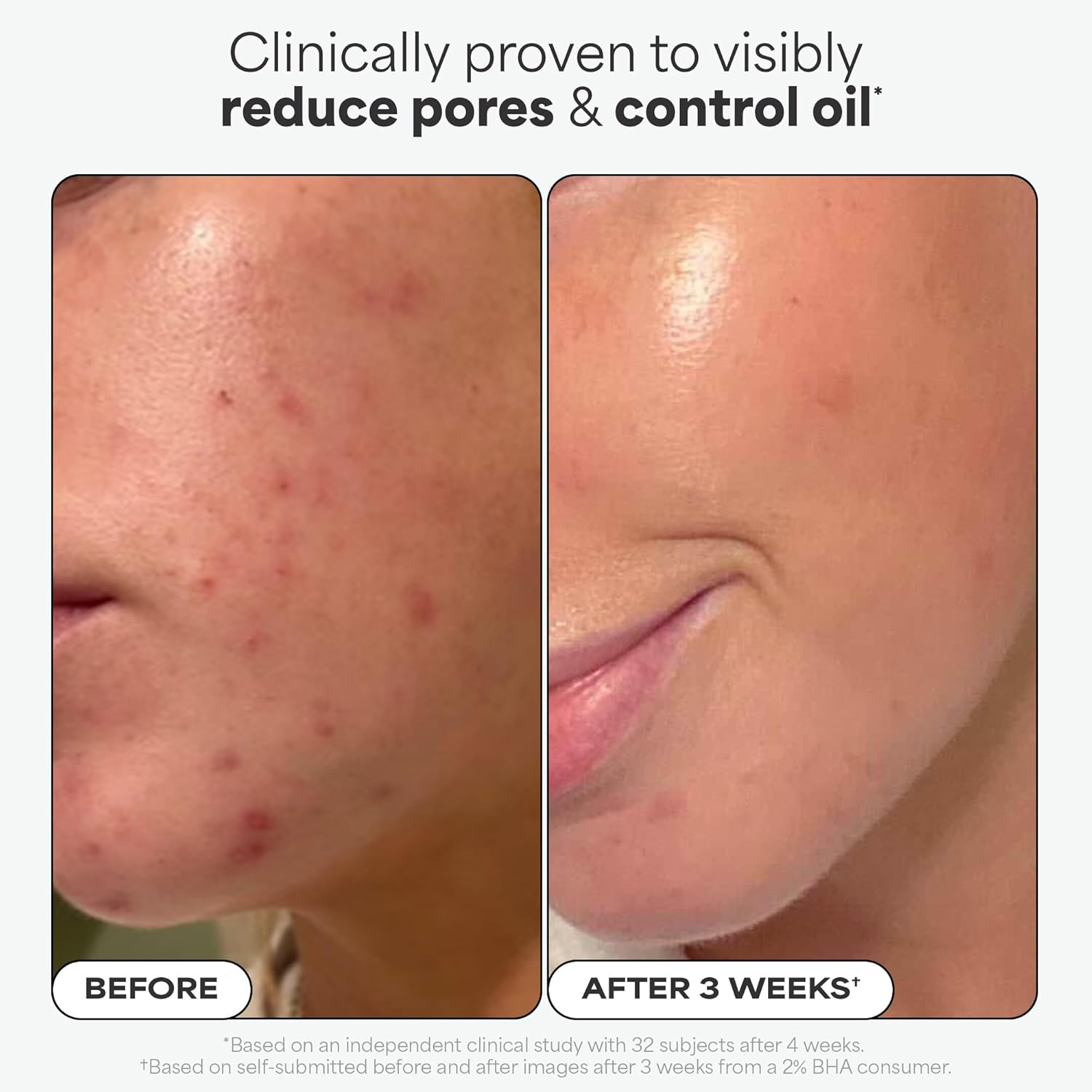 ClearSkin Daily BHA Solution